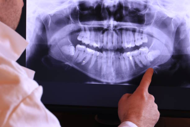Best Emergency Gum Treatment in Mounds, OK