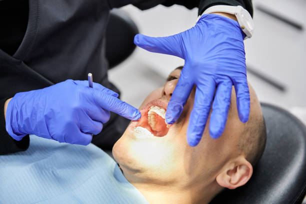 Best Emergency Gum Treatment in Mounds, OK